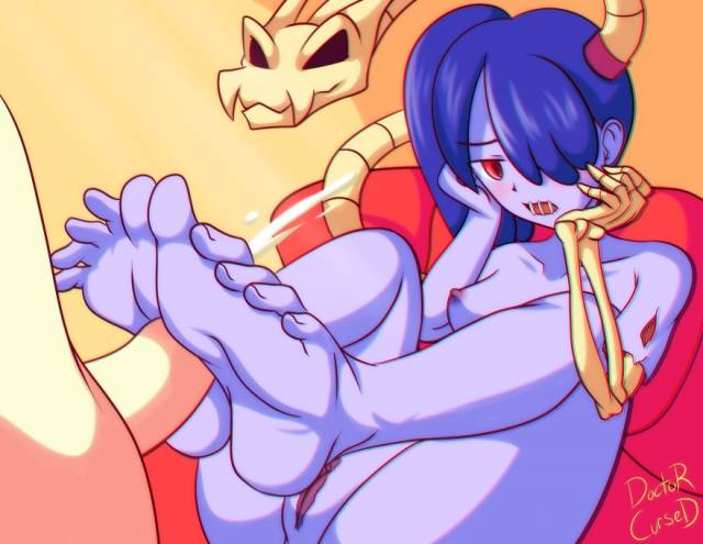 squigly